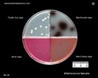 Enterococcus on different cultivation media